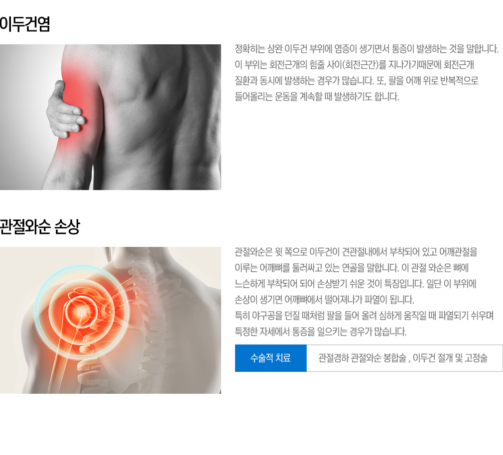 충돌증후군