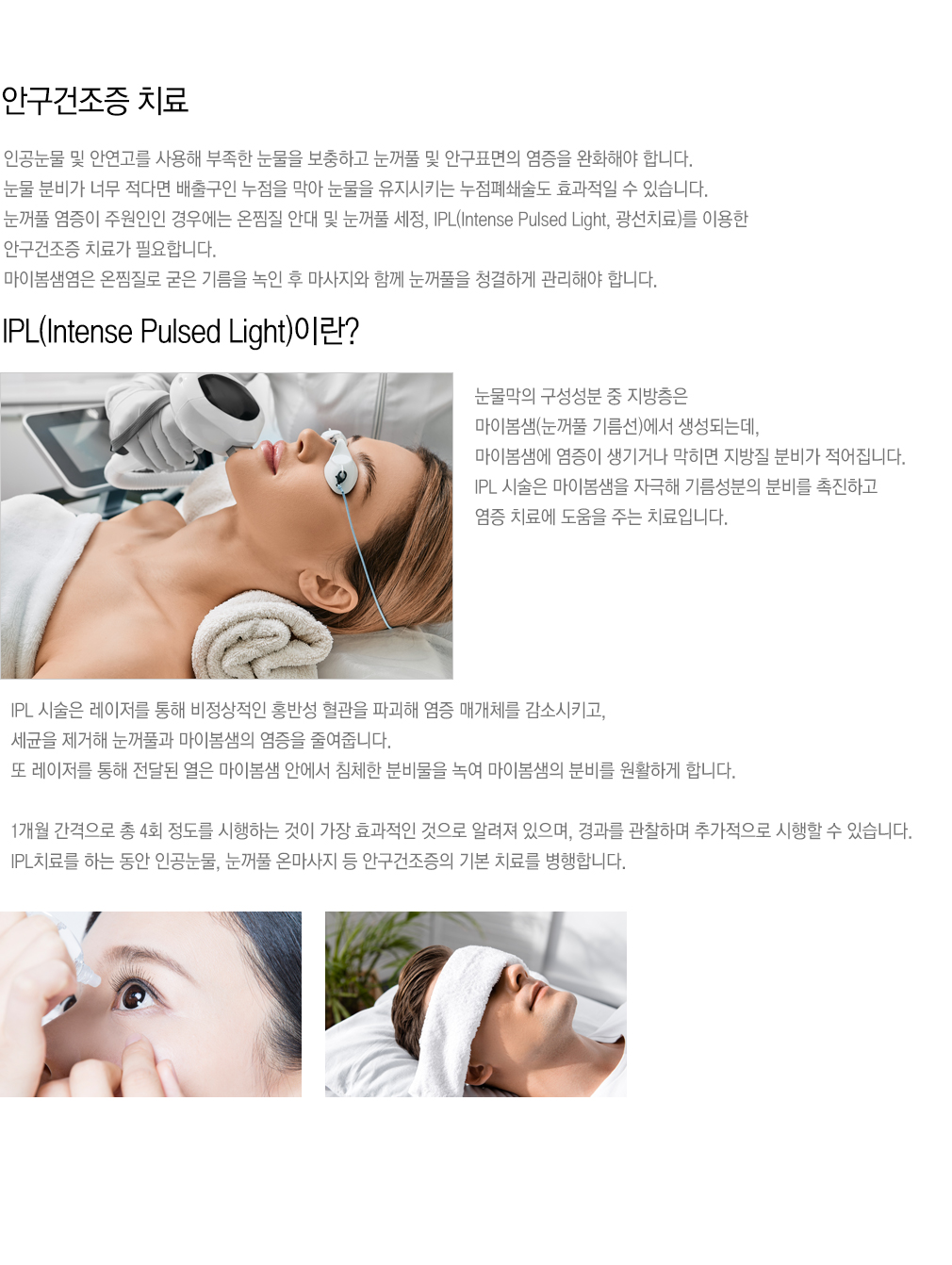 안구건조증 치료