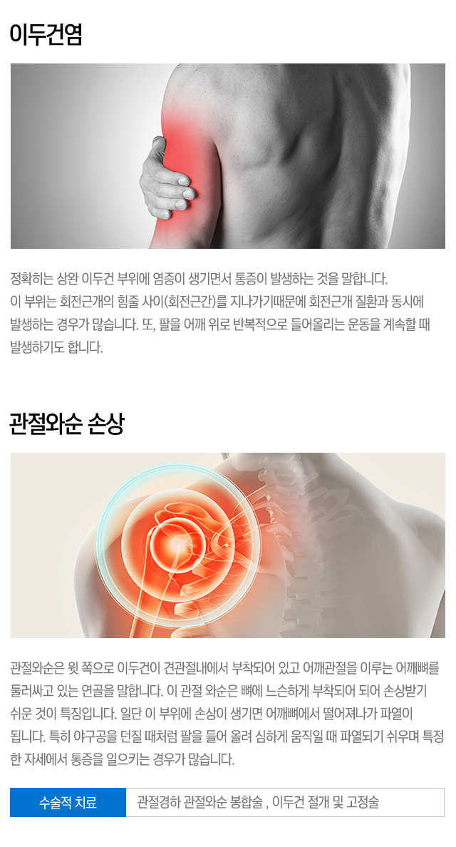기타어깨질환
