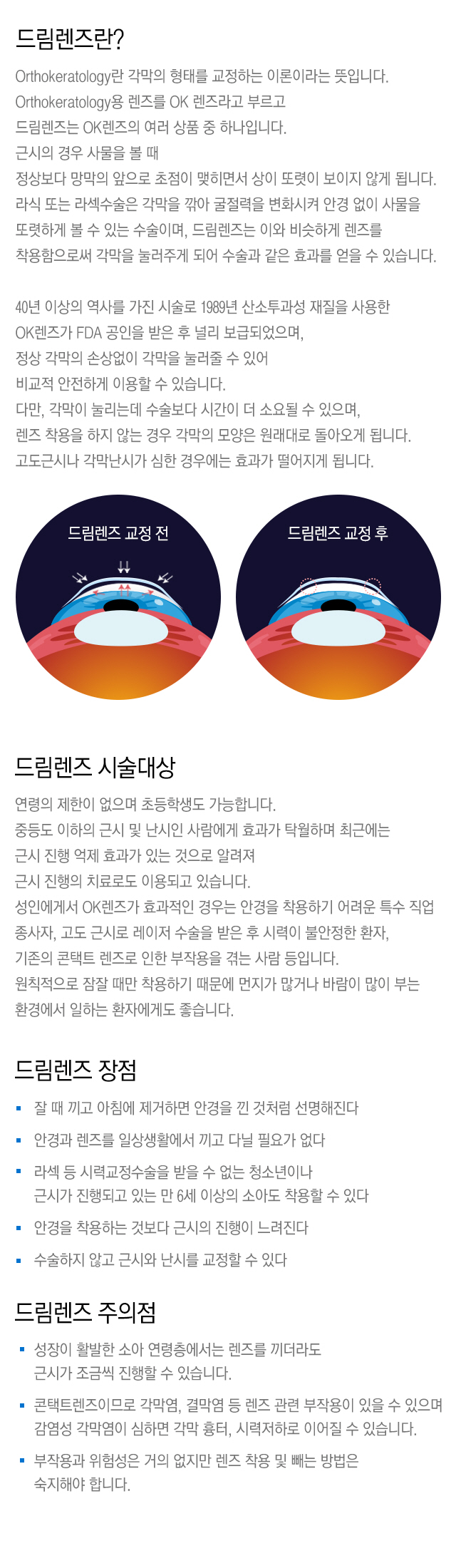 드림렌즈